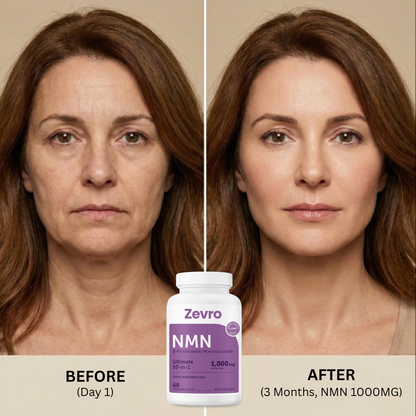 Zevro™ Nicotinamide Mononucleotide